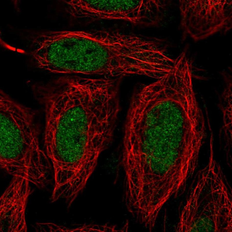 Atlas Antibodies Anti-SNAI1 Antibody