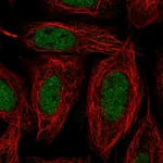 Atlas Antibodies Anti-SNAI1 Antibody