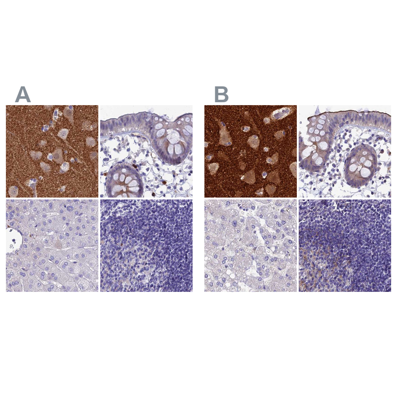 Atlas Antibodies Anti-SNAP91 Antibody