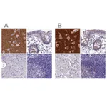 Atlas Antibodies Anti-SNAP91 Antibody