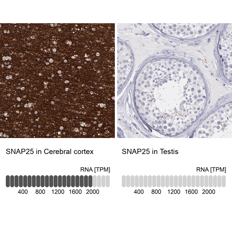 Atlas Antibodies Anti-SNAP25 Antibody