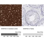 Atlas Antibodies Anti-SNAP25 Antibody