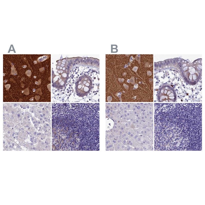 Atlas Antibodies Anti-SNAP91 Antibody