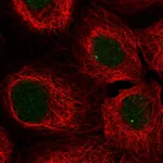 Atlas Antibodies Anti-SNAPC3 Antibody