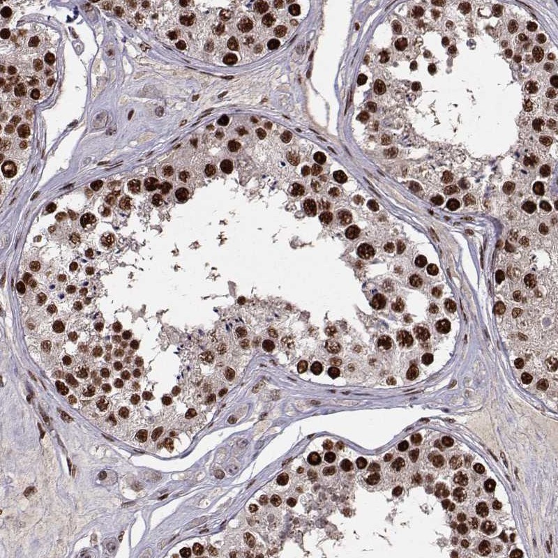 Atlas Antibodies Anti-SNAPC2 Antibody
