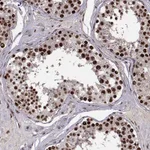Atlas Antibodies Anti-SNAPC2 Antibody