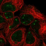 Atlas Antibodies Anti-SNAPC2 Antibody