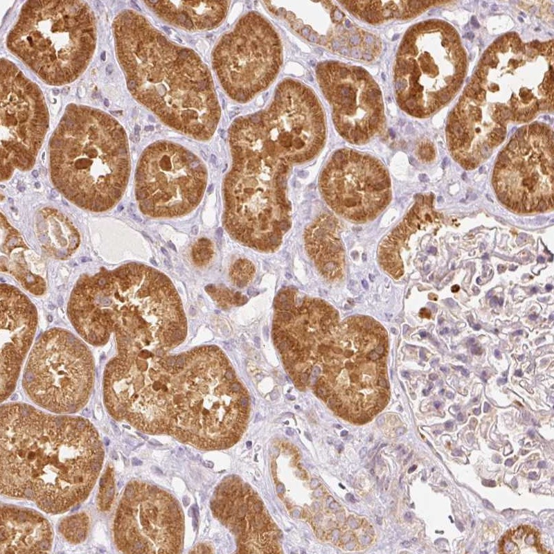 Atlas Antibodies Anti-SNAPC5 Antibody