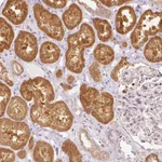 Atlas Antibodies Anti-SNAPC5 Antibody