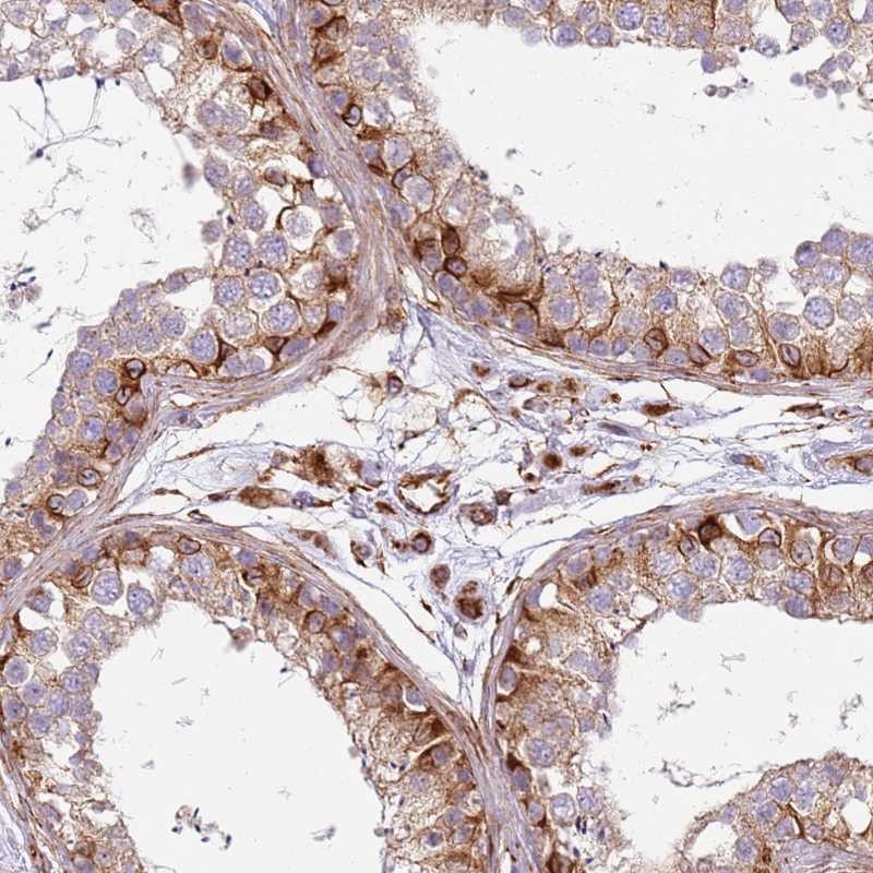 Atlas Antibodies Anti-SNAPIN Antibody