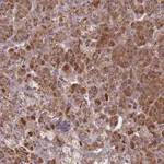 Atlas Antibodies Anti-SNAPC4 Antibody