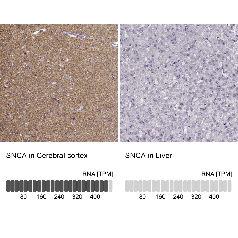 Atlas Antibodies Anti-SNCA Antibody