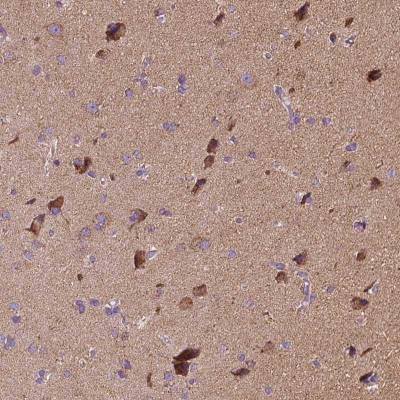 Atlas Antibodies Anti-SNCAIP Antibody
