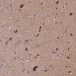 Atlas Antibodies Anti-SNCAIP Antibody