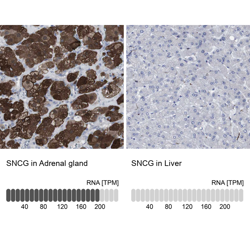 Atlas Antibodies Anti-SNCG Antibody