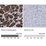 Atlas Antibodies Anti-SNCG Antibody