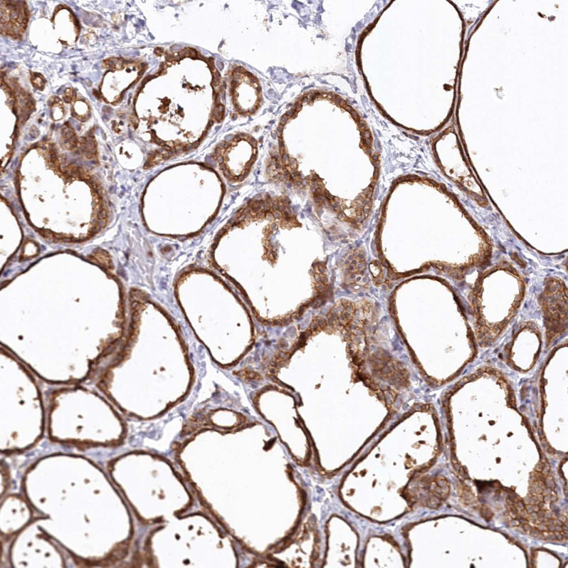 Atlas Antibodies Anti-SNED1 Antibody