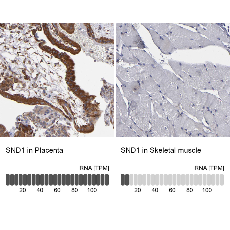 Atlas Antibodies Anti-SND1 Antibody