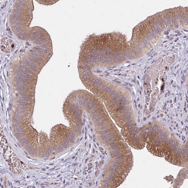 Atlas Antibodies Anti-SNF8 Antibody