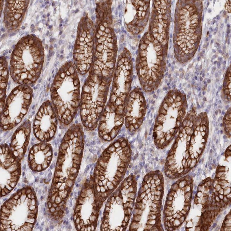 Atlas Antibodies Anti-SNED1 Antibody