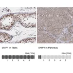 Atlas Antibodies Anti-SNIP1 Antibody