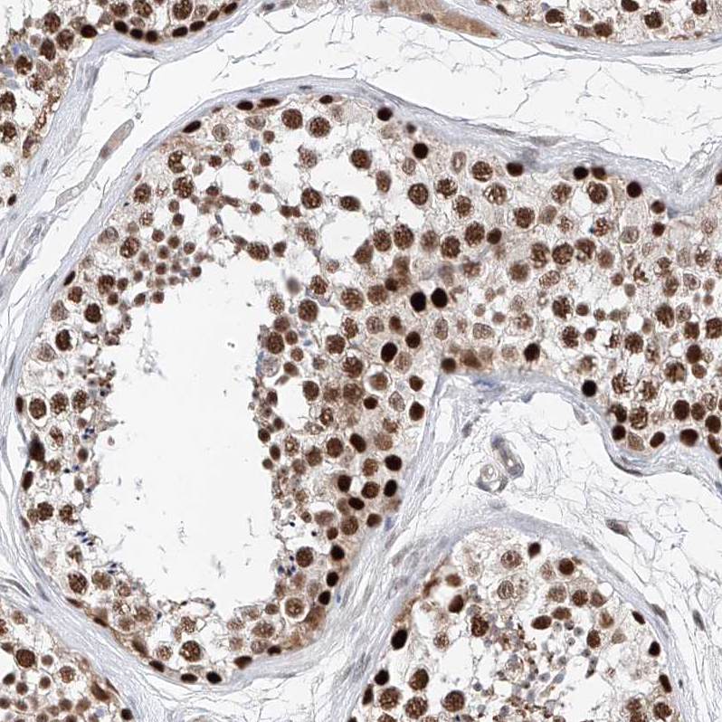 Atlas Antibodies Anti-SNRNP200 Antibody