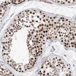 Atlas Antibodies Anti-SNRNP200 Antibody
