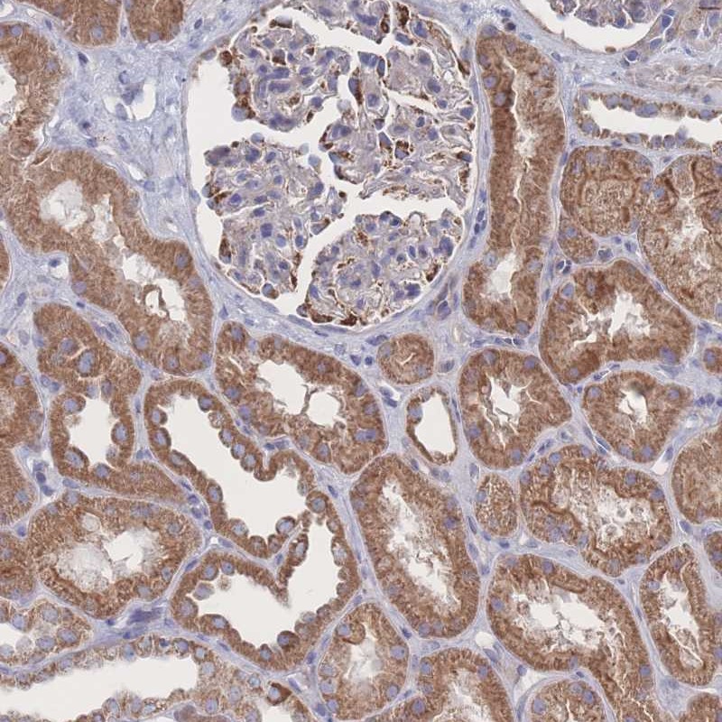Atlas Antibodies Anti-SNPH Antibody