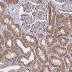Atlas Antibodies Anti-SNPH Antibody