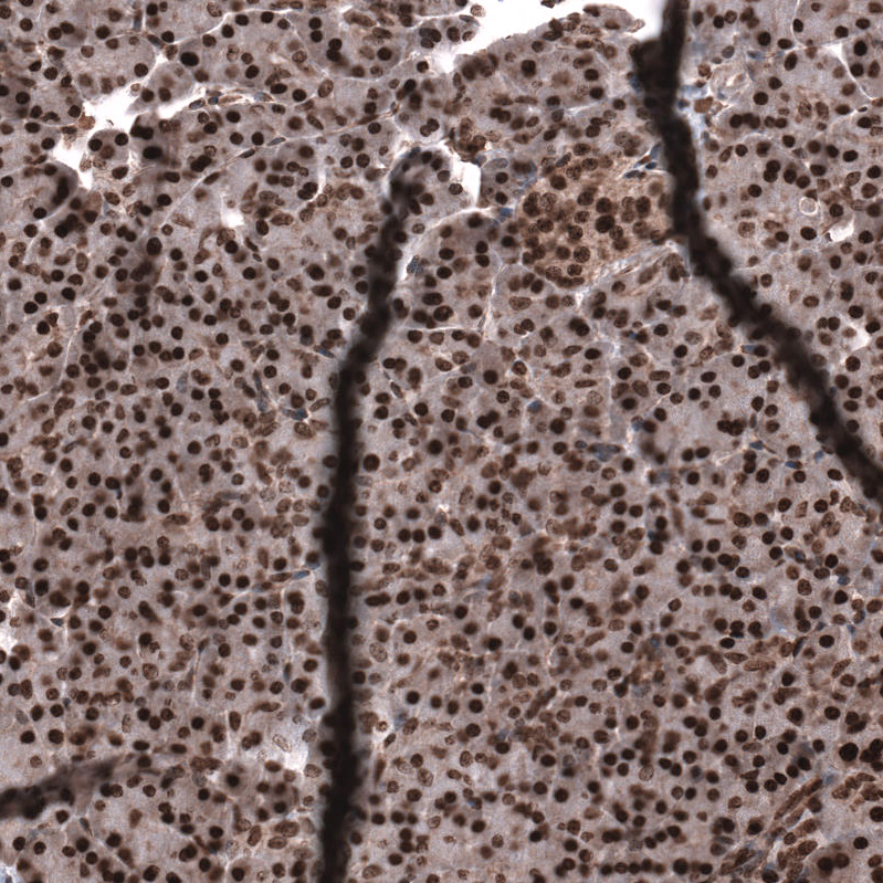 Atlas Antibodies Anti-SNRK Antibody