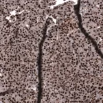 Atlas Antibodies Anti-SNRK Antibody