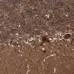 Atlas Antibodies Anti-SNRNP25 Antibody
