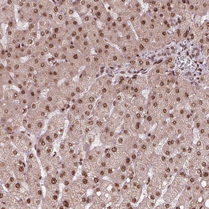 Atlas Antibodies Anti-SNRNP35 Antibody