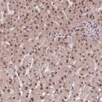 Atlas Antibodies Anti-SNRNP35 Antibody