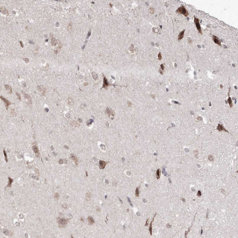 Atlas Antibodies Anti-SNRNP27 Antibody
