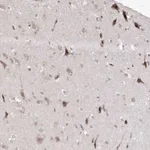Atlas Antibodies Anti-SNRNP27 Antibody