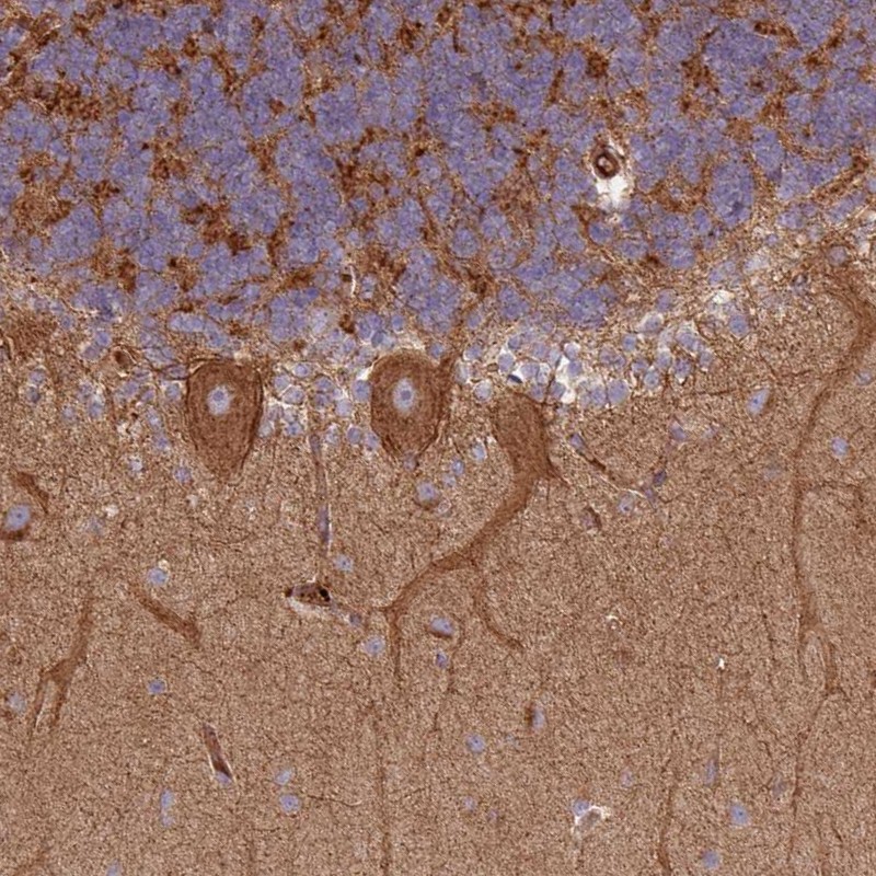 Atlas Antibodies Anti-SNRNP25 Antibody