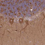 Atlas Antibodies Anti-SNRNP25 Antibody