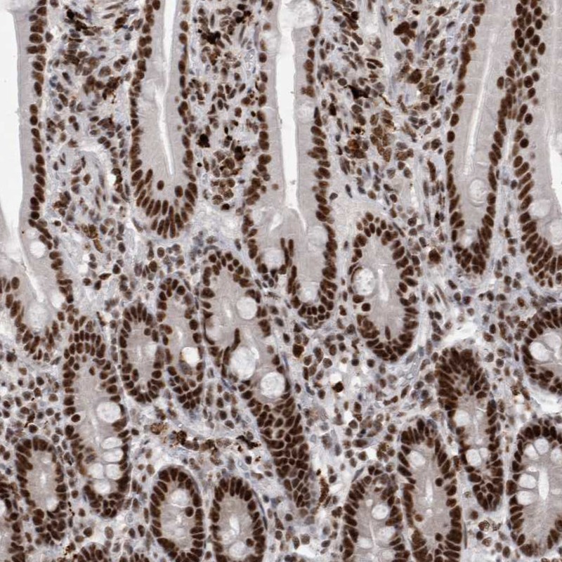 Atlas Antibodies Anti-SNRNP40 Antibody