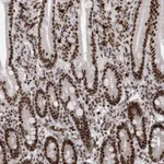 Atlas Antibodies Anti-SNRNP40 Antibody