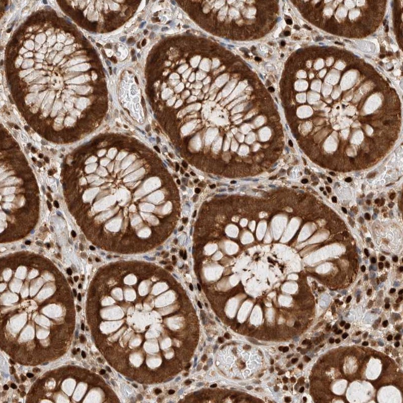 Atlas Antibodies Anti-SNRNP40 Antibody