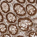 Atlas Antibodies Anti-SNRNP40 Antibody