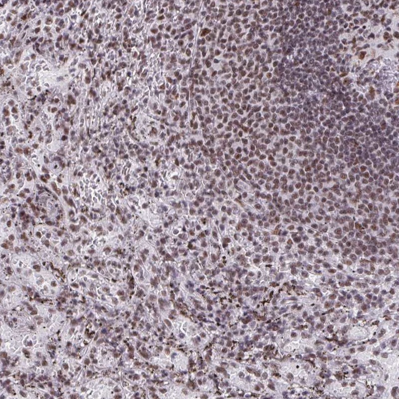 Atlas Antibodies Anti-SNRNP70 Antibody