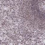 Atlas Antibodies Anti-SNRNP70 Antibody