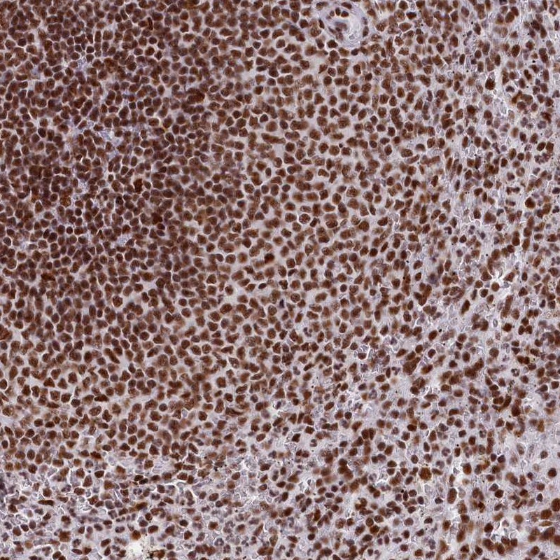 Atlas Antibodies Anti-SNRNP70 Antibody