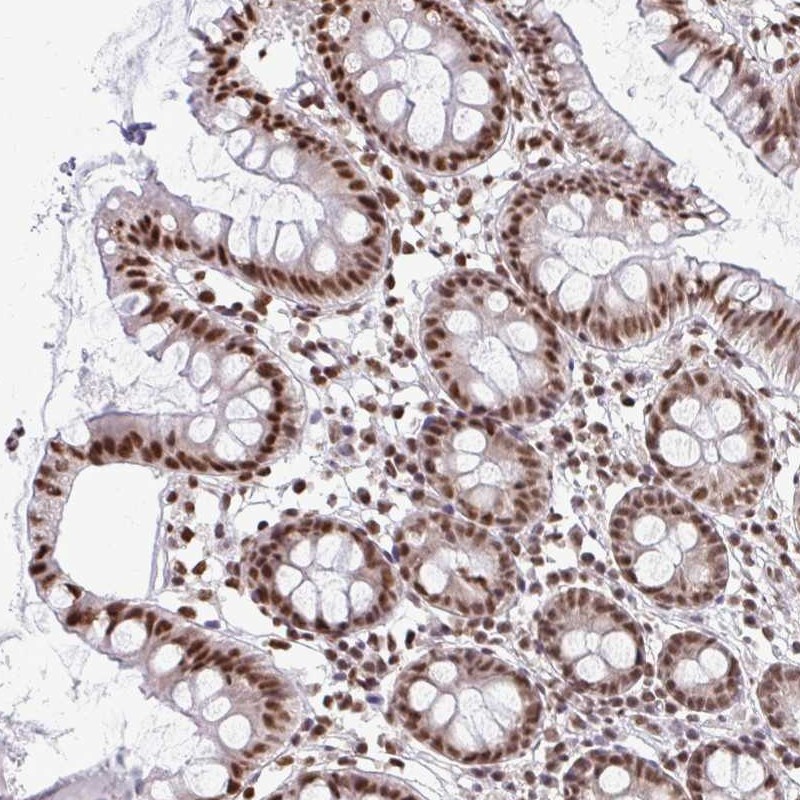 Atlas Antibodies Anti-SNRPA Antibody