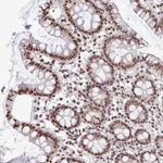 Atlas Antibodies Anti-SNRPA Antibody