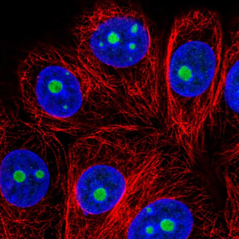 Atlas Antibodies Anti-SNRNP35 Antibody