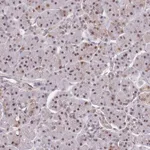 Atlas Antibodies Anti-SNRPA1 Antibody