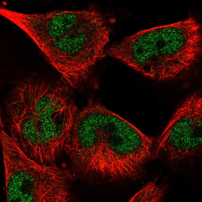 Atlas Antibodies Anti-SNRPA Antibody